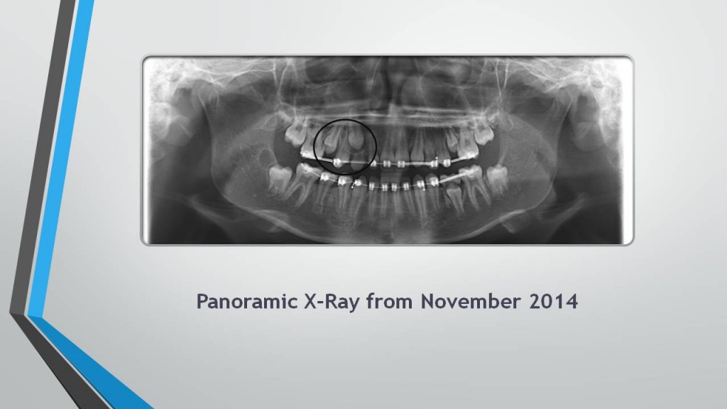 The importance of Panoramic XRays McSurdy Orthodontics