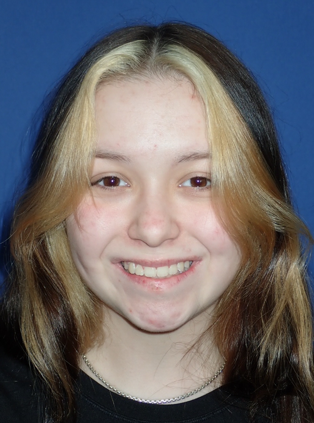 Patient at McSurdy Orthodontics in Gilbertsville and Collegeville PA
