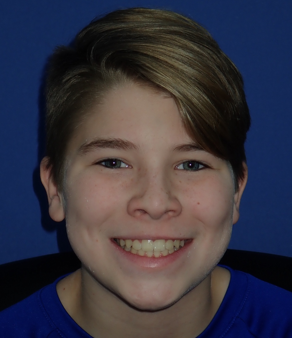 Patient at McSurdy Orthodontics in Gilbertsville and Collegeville PA